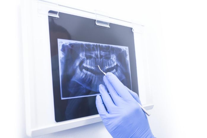 Zahnkosmetik-Moderne Technologien für perfekte Zähne